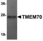 Western blot analysis of TMEM70 in human liver tissue lysate with TMEM70 antibody at 1 ug/mL.