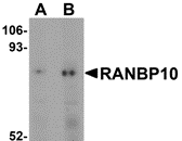 Western blot analysis of RANBP10 in human skeletal muscle tissue lysate with RANBP10 antibody at (A) 1 and (B) 2 ug/mL.