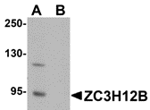 Western blot analysis of ZC3H12B in mouse brain tissue lysate with ZC3H12B antibody at 1 ug/mL in (A) the absence and (B) the presence of blocking peptide.