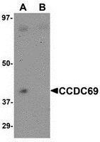 Western blot analysis of CCDC69 in mouse lung tissue lysate with CCDC69 antibody at 1 ug/mL in (A) the absence and (B) the presence of blocking peptide.