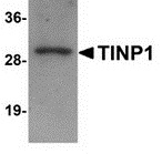 Western blot analysis of TINP1 in rat brain tissue lysate with TINP1 antibody at (A) 1 and (B) 2 ug/mL.