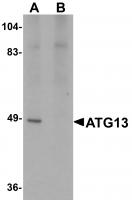 Western blot analysis of ATG13 in rat heart tissue lysate with ATG13 antibody at 1 ug/mL in (A) the absence and (B) the presence of blocking peptide.