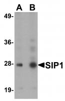 Western blot analysis of SIP1 in HeLa cell lysate with SIP1 antibody at (A) 0.5 and (B) 1ug/mL.