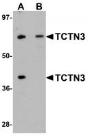 Western blot analysis of TCTN3 in HeLa cell lysate with TCTN3 antibody at (A) 1 and (B) 2ug/mL.