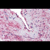 Immunohistochemistry of SCUBE3 in blood vessel tissue with SCUBE3 antibody at 10 ug/mL.