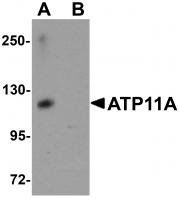 Western blot analysis of ATP11A in K562 cell tissue lysate with ATP11A antibody at 1 ug/mL in (A) the absence and (B) the presence of blocking peptide.