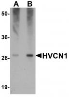 Western blot analysis of HVCN1 in human spleen tissue lysate with HVCN1 antibody at (A) 0.5 and (B) 1 ug/mL.