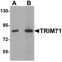 Western blot analysis of TRIM71 in human brain tissue lysate with TRIM71 antibody at (A) 1 and (B) 2 ug/mL.