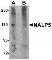 Western blot analysis of NALP5 in mouse brain tissue lysate with NALP5 antibody at 1 ug/mL in (A) the absence and (B) the presence of blocking peptide.