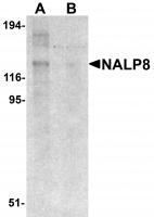 Western blot analysis of NALP8 in human colon tissue lysate with NALP8 antibody at 1 ug/mL in (A) the absence and (B) the presence of blocking peptide.