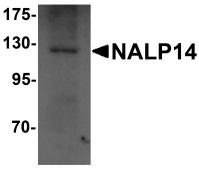 Western blot analysis of NALP14 in rat brain tissue lysate with NALP14 antibody at 1 ug/mL.