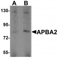 Western blot analysis of APBA2 in human brain tissue lysate with APBA2 antibody at (A) 1 and (B) 2 ug/mL.