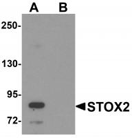 Western blot analysis of STOX2 in human kidney tissue lysate with STOX2 antibody at 1 ug/mL in (A) the absence and (B) the presence of blocking peptide.