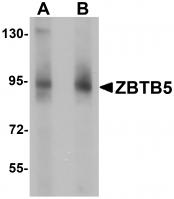 Western blot analysis of ZBTB5 in mouse brain tissue lysate with ZBTB5 antibody at (A) 1 and (B) 2 ug/mL.