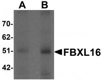 Western blot analysis of FBXL16 in human spleen tissue lysate with FBXL16 antibody at (A) 0.5 and (B) 1 ug/mL.