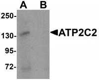Western blot analysis of ATP2C2 in 3T3 cell lysate with ATP2C2 antibody at 1 ug/mL in (A) the absence and (B) the presence of blocking peptide
