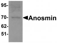 Western blot analysis of Anosmin in MCF7 cell lysate with Anosmin antibody at 1 ug/mL.