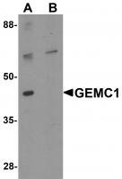 Western blot analysis of GEMC1 in mouse heart tissue lysate with GEMC1 antibody at 1 ug/mL in (A) the absence and (B) the presence of blocking peptide