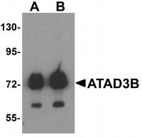 Western blot analysis of ATAD3B in human kidney tissue lysate with ATAD3B antibody at (A) 1 and (B) 2 ug/mL.