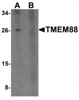 Western blot analysis of TMEM88 in human brain tissue lysate with TMEM88 antibody at 1 ug/mL in (A) the absence and (B) the presence of blocking peptide.