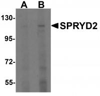 Western blot analysis of SPRYD2 in rat brain tissue lysate with SPRYD2 antibody at (A) 1 and (B) 2 ug/mL