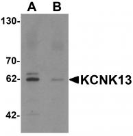 Western blot analysis of KCNK13 in rat brain tissue lysate with KCNK13 antibody at 0.5 ug/mL in (A) the absence and (B) the presence of blocking peptide.