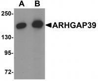 Western blot analysis of ARHGAP39 in A20 cell lysate with ARHGAP39 antibody at (A) 1 and (B) 2 ug/mL