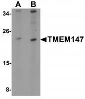Western blot analysis of TMEM147 in Daudi cell lysate with TMEM147 antibody at (A) 1 and (B) 2 ug/mL.