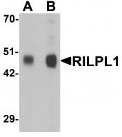 Western blot analysis of RILPL1 in rat cerebellum tissue lysate with RILPL1 antibody at (A) 0.5 and (B) 1 ug/mL.