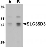 Western blot analysis of SLC35D3 in HeLa cell lysate with SLC35D3 antibody at (A) 1 and (B) 2 ug/mL.