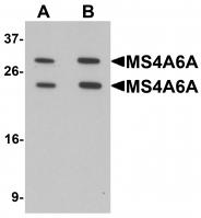 Western blot analysis of MS4A6A in 293 cell lysate with MS4A6A antibody at (A) 1 and (B) 2 ug/mL.