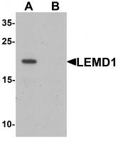 Western blot analysis of LEMD1 in A20 cell lysate with LEMD1 antibody at 1 ug/mL in (A) the absence and (B) the presence of blocking peptide.