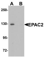 Western blot analysis of EPAC2 in rat liver tissue lysate with EPAC2 antibody at 1 ug/mL in (A) the absence and (B) the presence of blocking peptide.