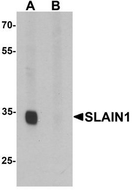 Western blot analysis of SLAIN1 in A549 cell lysate with SLAIN1 antibody at 1 ug/mL in (A) the absence and (B) the presence of blocking peptide.