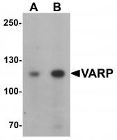 Western blot analysis of VARP in K562 cell lysate with VARP antibody at (A) 1 and (B) 2 ug/mL.