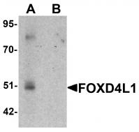 Western blot analysis of FOXD4L1 in A-20 cell lysate with FOXD4L1 antibody at 1 ug/mL in (A) the absence and (B) the presence of blocking peptide.