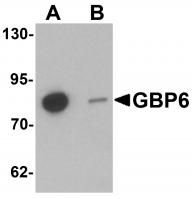Western blot analysis of GBP6 in Hela cell lysate with GBP6 antibody at 0.5 ug/mL in (A) the absence and (B) the presence of blocking peptide.
