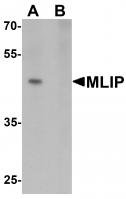 Western blot analysis of MLIP in 293 cell lysate with MLIP antibody at 1 ug/mL in (A) the absence and (B) the presence of blocking peptide.