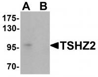Western blot analysis of TSHZ2 in A-20 cell lysate with TSHZ2 antibody at 1 ug/mL in (A) the absence and (B) the presence of blocking peptide.