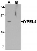 Western blot analysis of YPEL4 in SW480 cell lysate with YPEL4 antibody at 1 ug/mL in (A) the absence and (B) the presence of blocking peptide.