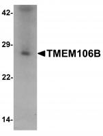 Western blot analysis of TMEM106B in human liver tissue lysate with TMEM106B antibody at 1 ug/mL.