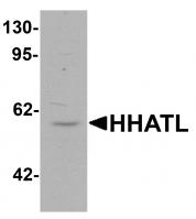 Western blot analysis of HHATL in 3T3 cell lysate with HHATL antibody at 1 ug/mL.