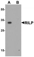 Western blot analysis of RILP in A20 cell lysate with RILP antibody at 1 ug/mL.