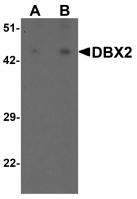 Western blot analysis of DBX2 in human kidney tissue lysate with DBX2 antibody at (A) 1 and (B) 2 ug/mL.