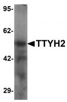 Western blot analysis of TTYH2 in human kidney tissue lysate with TTYH2 antibody at 1 ug/ml