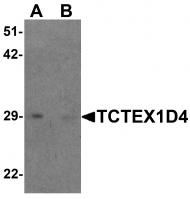 Western blot analysis of TCTEX1D4 in mouse liver tissue lysate with TCTEX1D4 antibody at 1 ug/mL in (A) the absence and (B) the presence of blocking peptide.