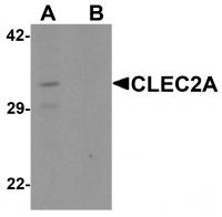 Western blot analysis of CLEC2A in K562 cell lysate with CLEC2A antibody at 1 ug/ml in (A) the absence and (B) the presence of blocking peptide.