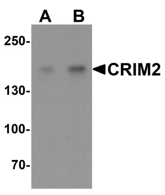 Western blot analysis of CRIM2 in Jurkat cell lysate with CRIM2 antibody at (A) 1 and (B) 2 ug/mL.