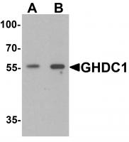 Western blot analysis of GHDC in 293 cell lysate with GHDC antibody at (A) 0.5 and (B) 1 ug/mL.