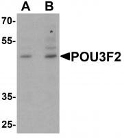 Western blot analysis of POU3F2 in 3T3 cell lysate with POU3F2 antibody at (A) 1 and (B) 2 ug/mL.